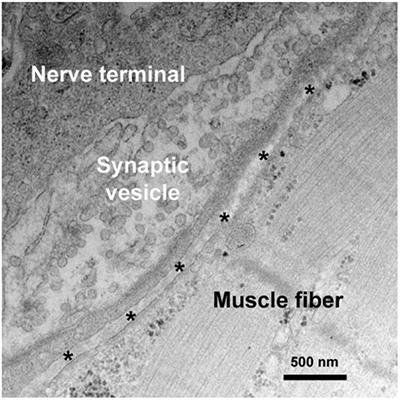 Autoimmune Channelopathies at Neuromuscular Junction